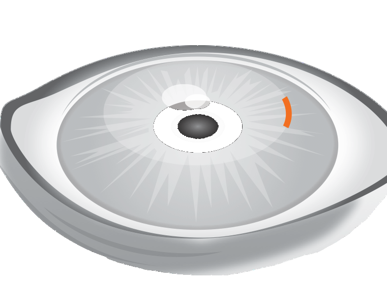 SMILE PRO Schnitt Detail